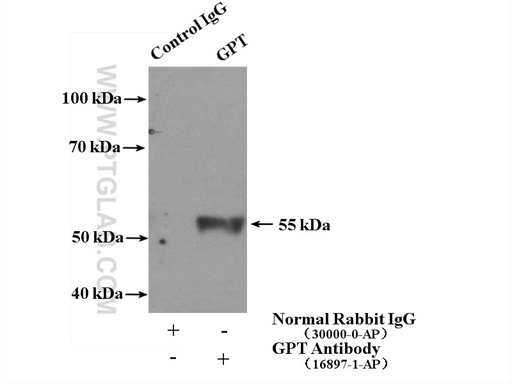 [16897-1-AP-20UL] GPT/ ALT1 Polyclonal antibody