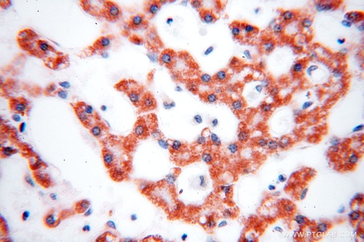 [16898-1-AP-20UL] HMGCL Polyclonal antibody