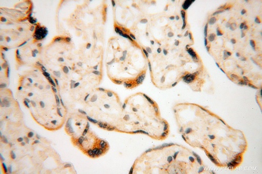 [16900-1-AP-150UL] GALNTL2 Polyclonal antibody