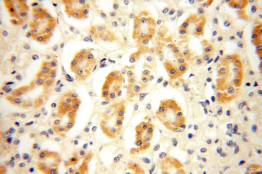 [16902-1-AP-150UL] NDUFB1 Polyclonal antibody
