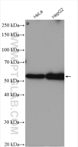 [16903-1-AP-20UL] UBR7 Polyclonal antibody
