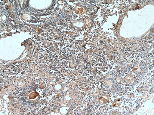 [16905-1-AP-20UL] UNC13D/Munc13-4 Polyclonal antibody