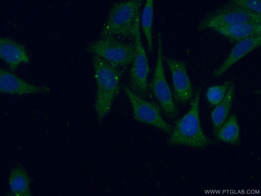 [16906-1-AP-20UL] PIGT Polyclonal antibody