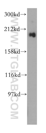[16909-1-AP-20UL] gp210 Polyclonal antibody