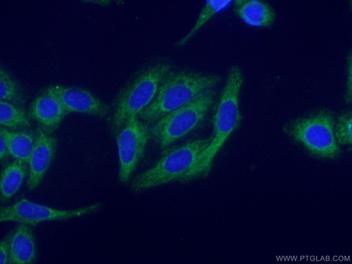 [16910-1-AP-150UL] PROS1 Polyclonal antibody
