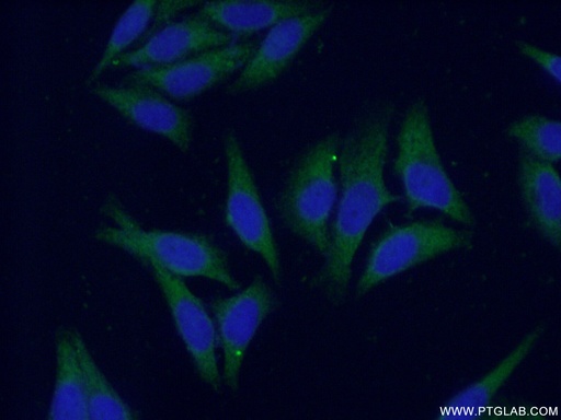 [16912-1-AP-20UL] CES1 Polyclonal antibody