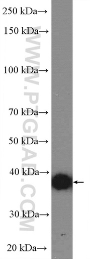[16913-1-AP-20UL] HLA-G Polyclonal antibody