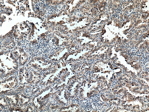 [16914-1-AP-20UL] FAM156A Polyclonal antibody