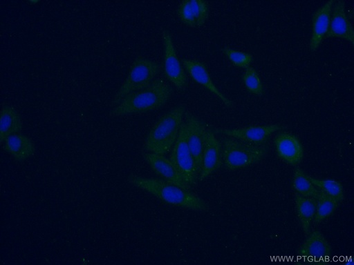 [16916-1-AP-20UL] KRCC1 Polyclonal antibody