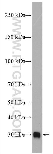 [16919-1-AP-150UL] C1qB Polyclonal antibody