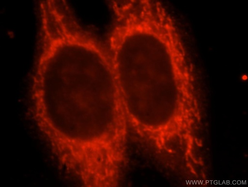 [16920-1-AP-20UL] Kir6.2 Polyclonal antibody