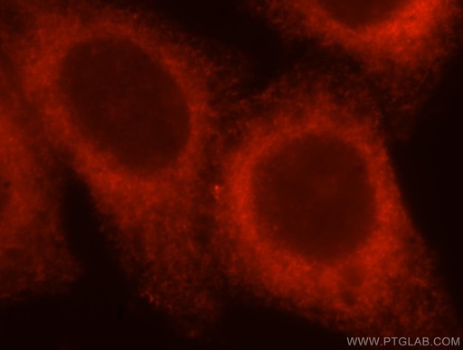 [16921-1-AP-20UL] ATL3 Polyclonal antibody