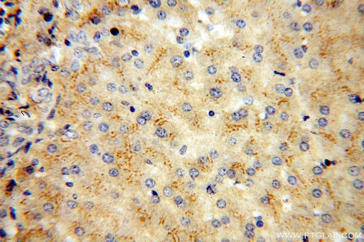 [16922-1-AP-150UL] vitamin D binding protein Polyclonal antibody