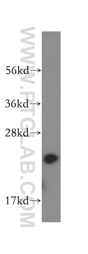 [16926-1-AP-150UL] Calcyphosine Polyclonal antibody
