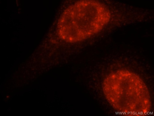 [16927-1-AP-150UL] DDX46 Polyclonal antibody