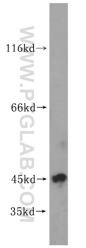 [16928-1-AP-150UL] UBE2Z Polyclonal antibody
