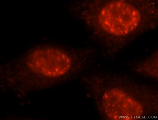 [16929-1-AP-20UL] PRPF40B Polyclonal antibody