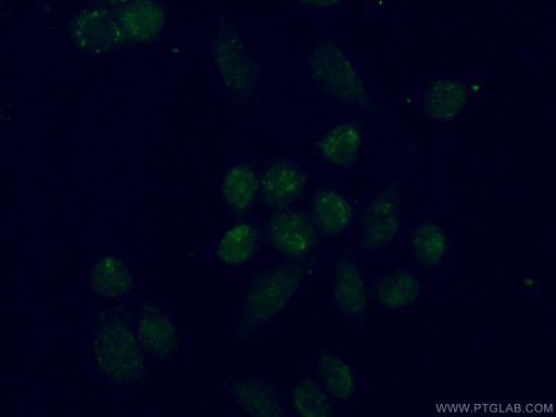 [16930-1-AP-20UL] TBX2 Polyclonal antibody