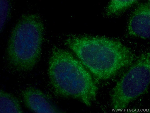 [16932-1-AP-20UL] AP1B1 Polyclonal antibody
