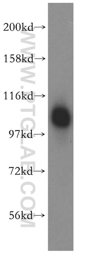 [16933-1-AP-150UL] FAM29A Polyclonal antibody