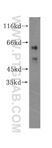 [16935-1-AP-150UL] ZNF35 Polyclonal antibody