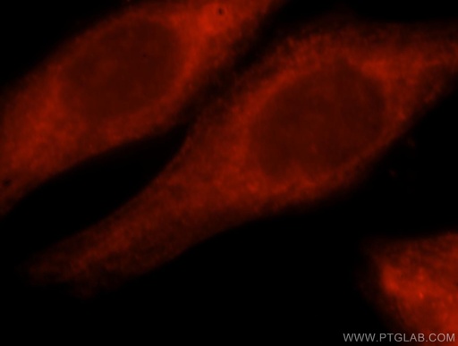 [16936-1-AP-20UL] RNF10 Polyclonal antibody