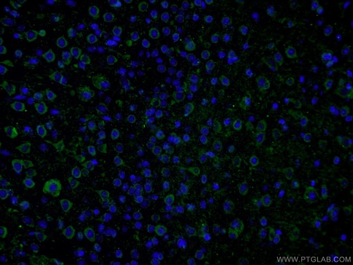 [16937-1-AP-150UL] PHYHIPL Polyclonal antibody
