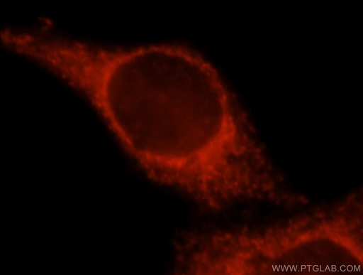 [16938-1-AP-20UL] SPATS2L Polyclonal antibody
