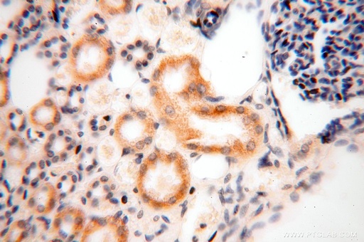 [16939-1-AP-150UL] GALNT14 Polyclonal antibody