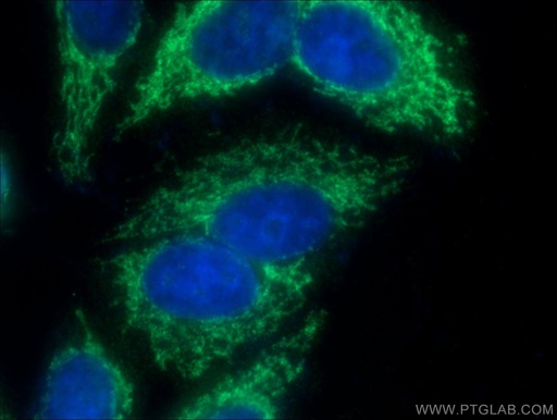 [16941-1-AP-20UL] GFM2 Polyclonal antibody