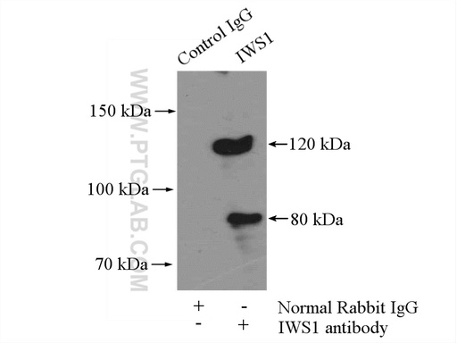 [16943-1-AP-150UL] IWS1 Polyclonal antibody