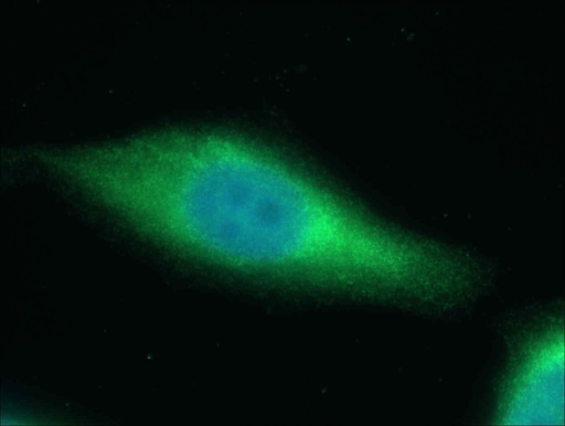 [16944-1-AP-20UL] SAPS3 Polyclonal antibody