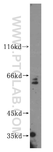 [16945-1-AP-150UL] PARP6 Polyclonal antibody