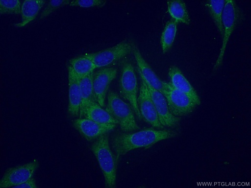 [16946-1-AP-20UL] RPS21 Polyclonal antibody