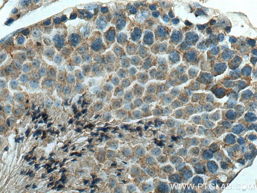 [16947-1-AP-20UL] DCTN6 Polyclonal antibody