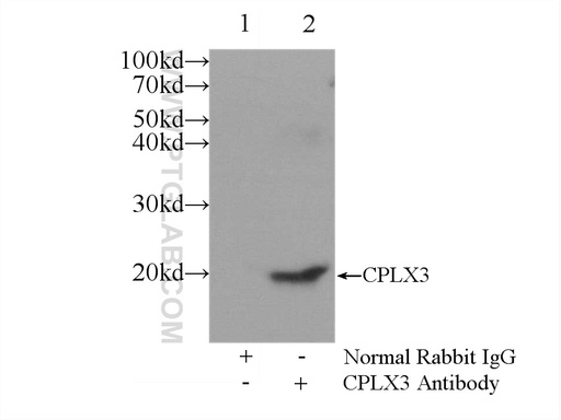 [16949-1-AP-20UL] CPLX3 Polyclonal antibody