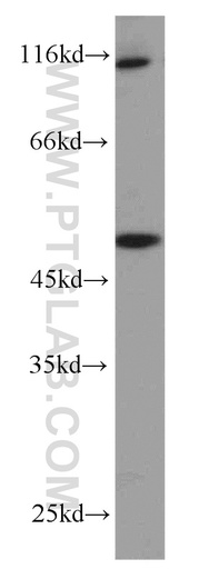 [16950-1-AP-150UL] ZNF3 Polyclonal antibody