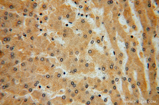 [16951-1-AP-20UL] KLHL3 Polyclonal antibody
