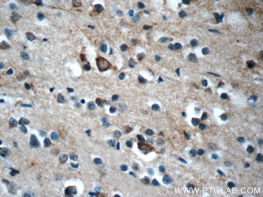 [16952-1-AP-150UL] KLHL21 Polyclonal antibody