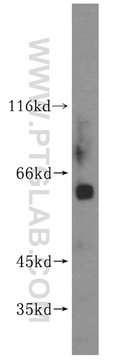 [16953-1-AP-150UL] MEF2C Polyclonal antibody
