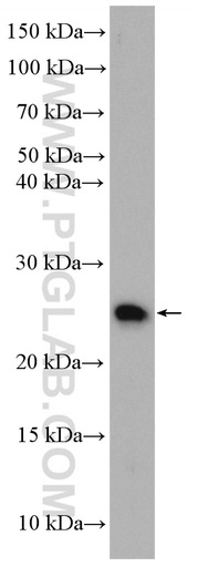 [16954-1-AP-20UL] N6AMT2 Polyclonal antibody