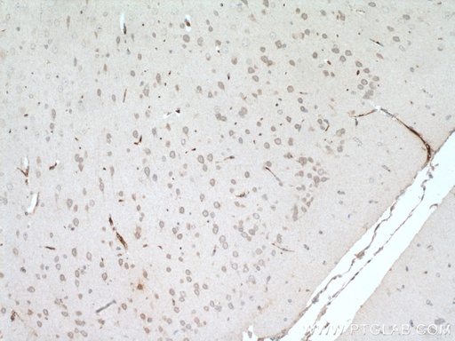 [16956-1-AP-20UL] ARL6IP6 Polyclonal antibody