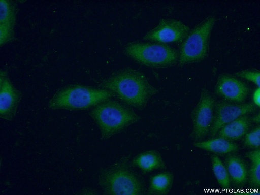 [16960-1-AP-20UL] Connexin-26 Polyclonal antibody