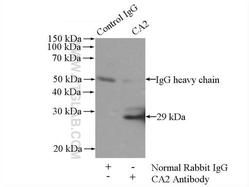 [16961-1-AP-150UL] CA2 Polyclonal antibody