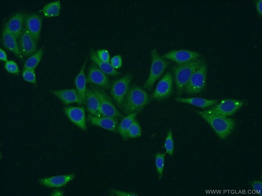 [16964-1-AP-20UL] RPS5 Polyclonal antibody