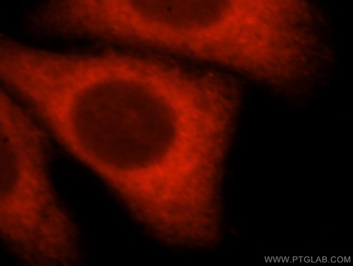[16965-1-AP-20UL] PNMAL1 Polyclonal antibody