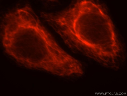 [16968-1-AP-150UL] PDRG1 Polyclonal antibody