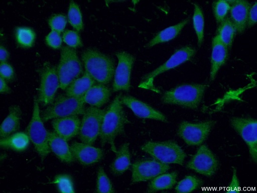 [16972-1-AP-150UL] Syntabulin Polyclonal antibody