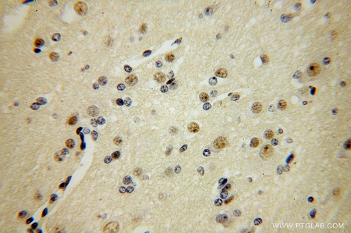 [16973-1-AP-150UL] FANCC Polyclonal antibody