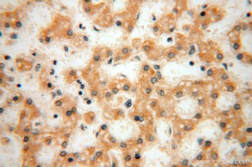 [16978-1-AP-150UL] MRPL21 Polyclonal antibody